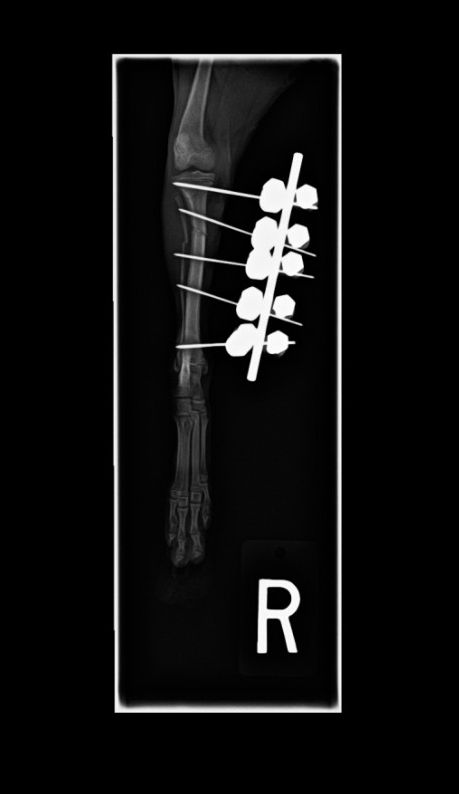 bone plating