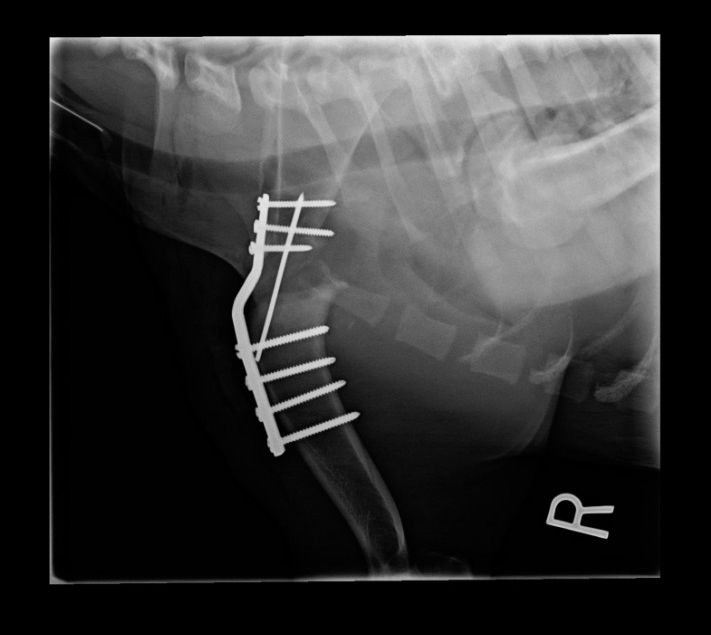 bone plating