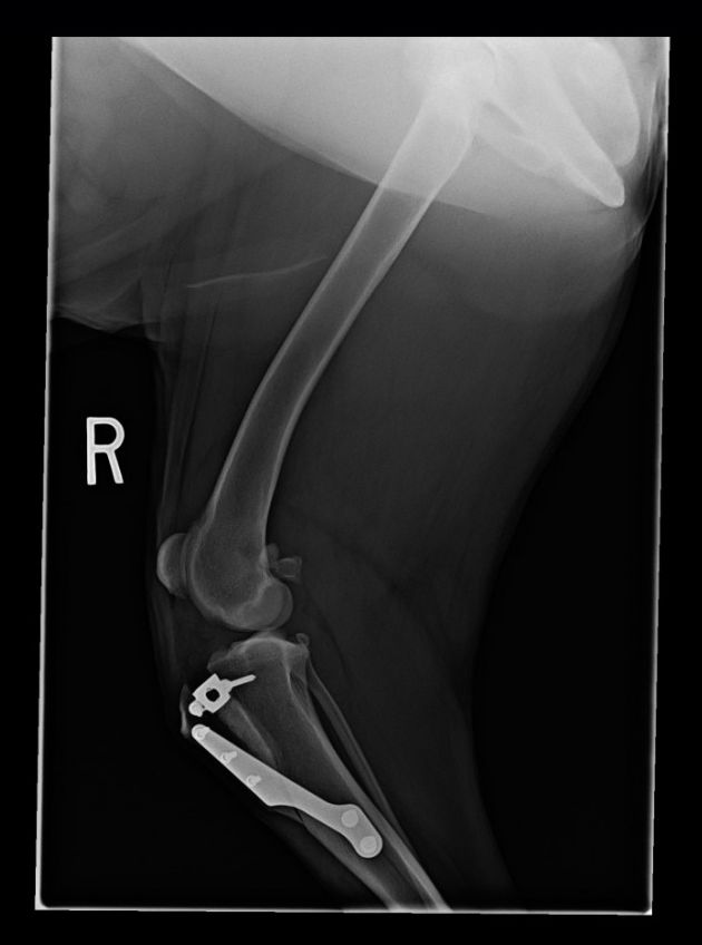X-ray from one of our TTA patients